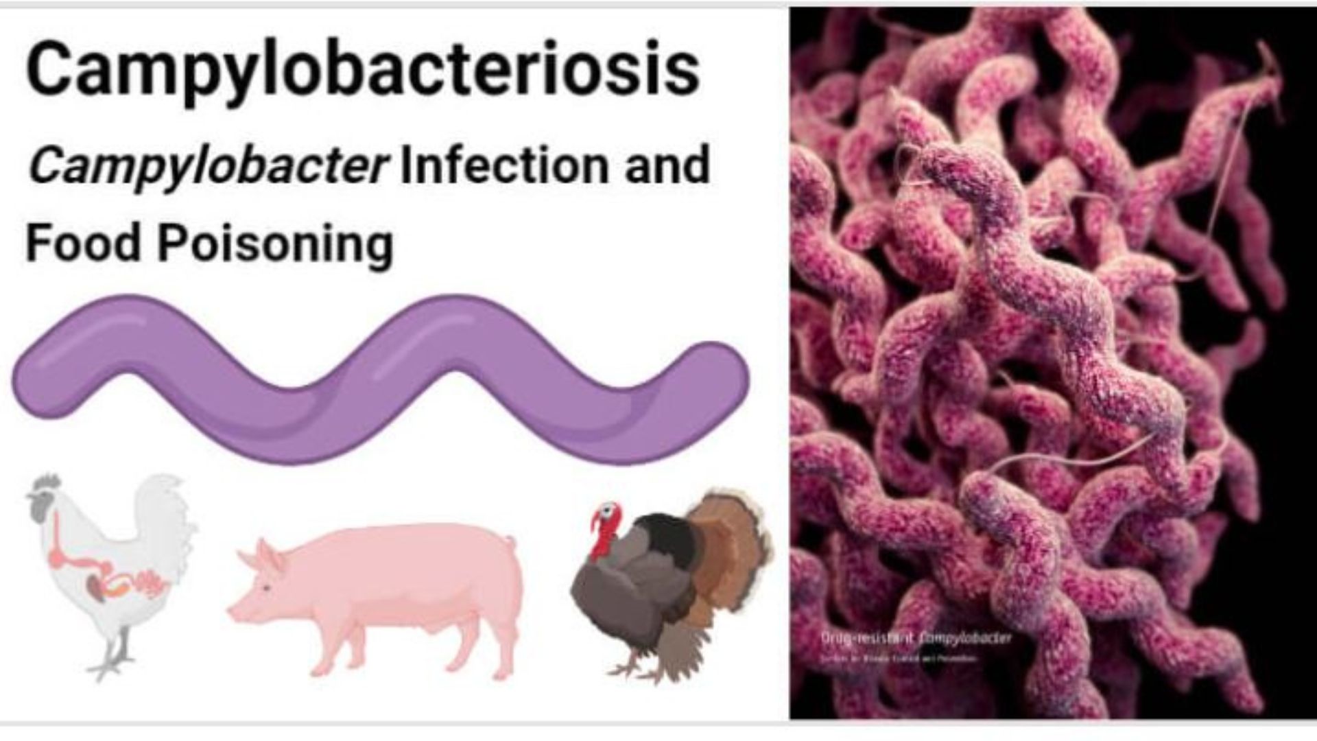 CAMPYLOBACTERIOSIS